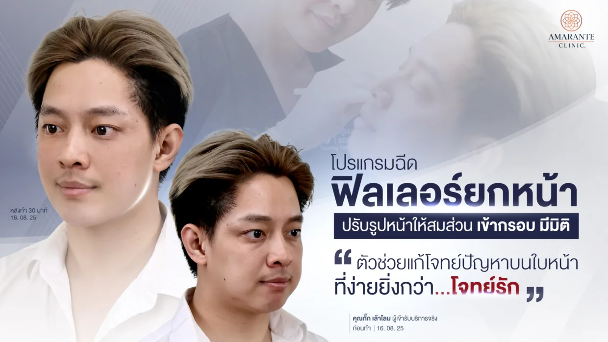 รีวิวฟิลเลอร์ยกหน้า คุณกั๊ก เล้าโลม แก้ทุกโจทย์ปัญหาใบหน้า ง่ายกว่าโจทย์รัก