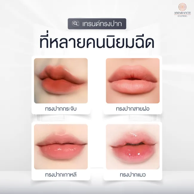 ทรงฟิลเลอร์ปากที่คนนิยมฉีด