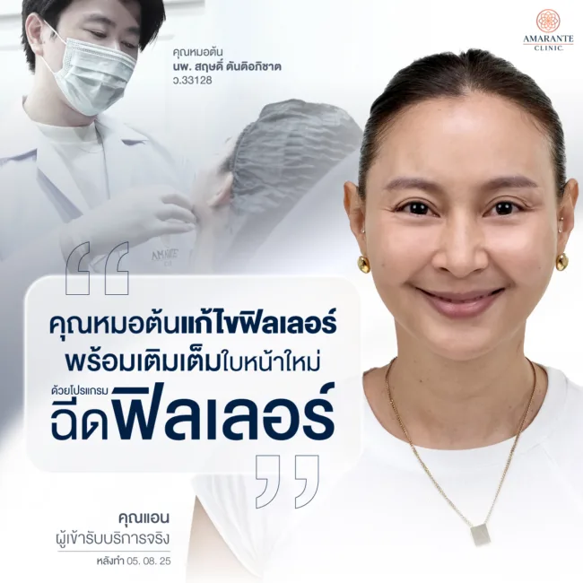 คุณหมอต้นแก้ไขฟิลเลอร์พร้อมเติมเต็มใบหน้าใหม่ด้วยฟิลเลอร์ให้คุณแอน