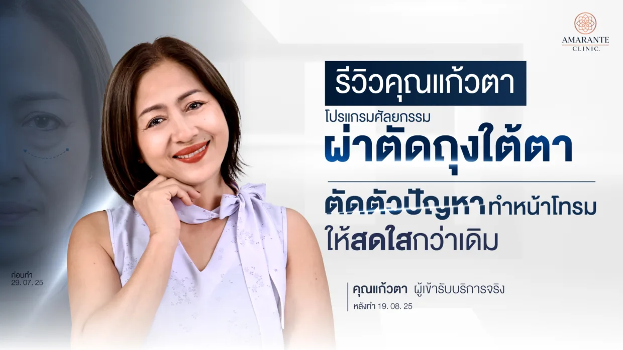 รีวิวผ่าตัดถุงใต้ตา คุณแก้วตา