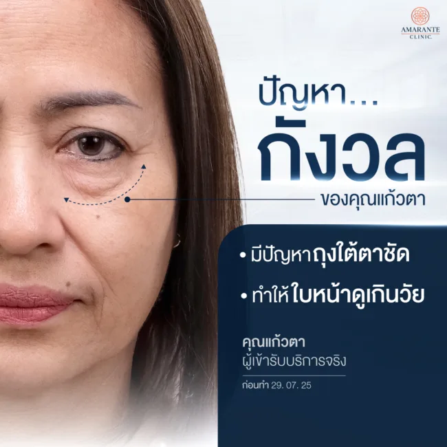 ปัญหาที่กังวลของคุณแก้วตา