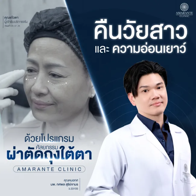 แก้ไขปัญหาถุงใต้ตาเทคนิคซ่อนแผลทำให้แผลเล็กโดยคุณหมอทศพลที่ Amarante Clinic