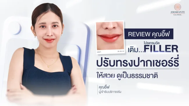 รีวิวฟิลเลอร์ปาก คุณอิ๊ฟ ปรับทรงรูปปากเชอรี่ให้สวยดูเป็นธรรมชาติ