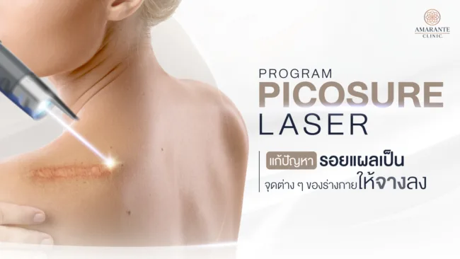 รอยแผลเป็น