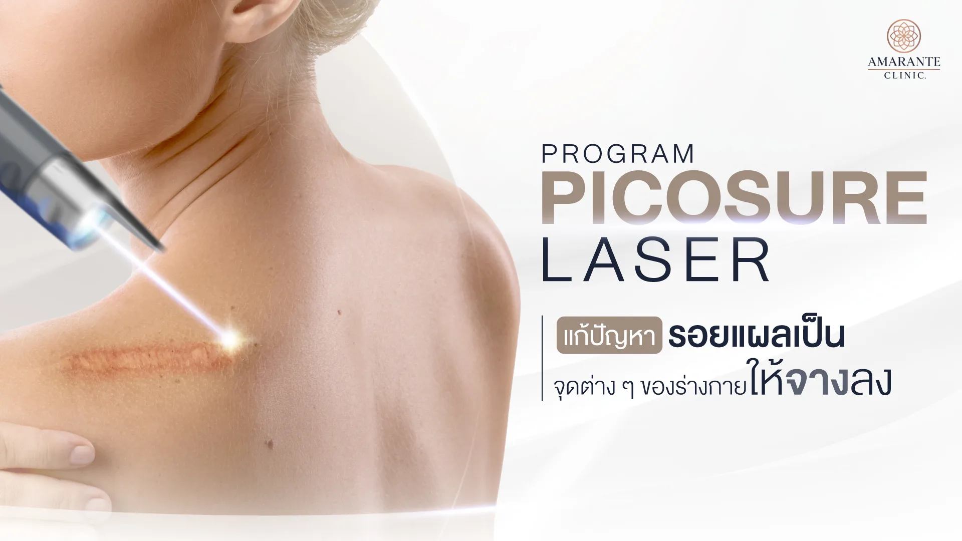 รอยแผลเป็น