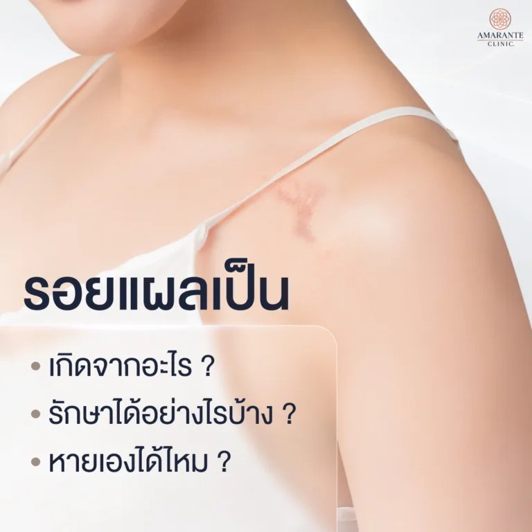 แผลเป็นเกิดจากอะไร