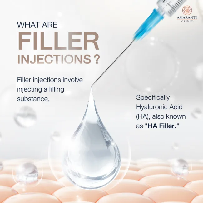 What are Filler Injections?