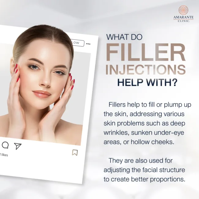 What do Filler Injections help with?