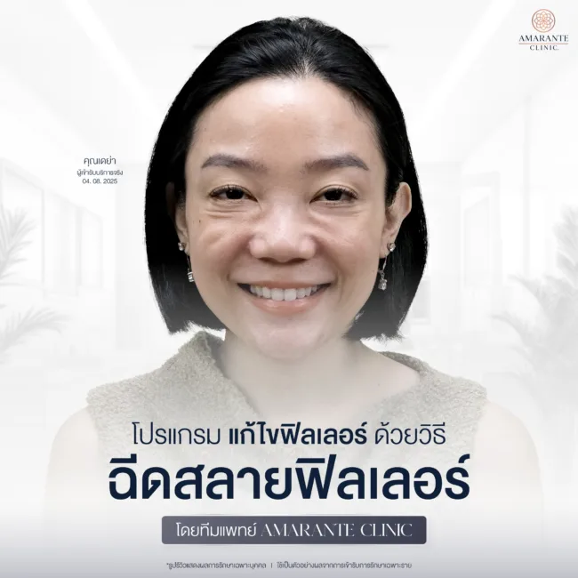 โปรแกรมสลายฟิลเลอร์