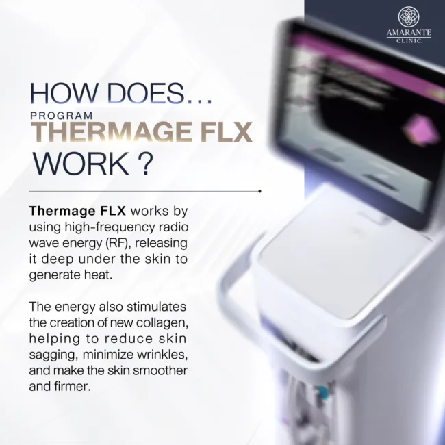 How does Thermage FLX work to lift the skin?