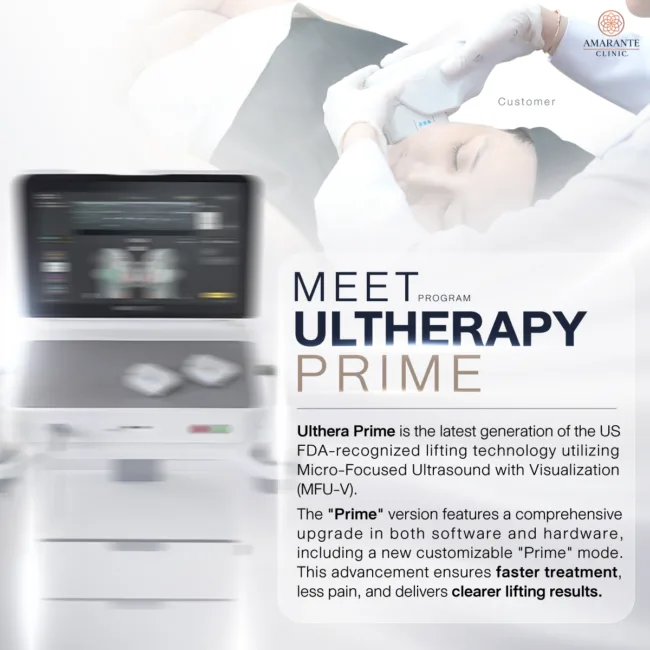 What is Ulthera Prime?