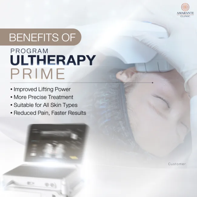 What are the benefits of Ulthera Prime?