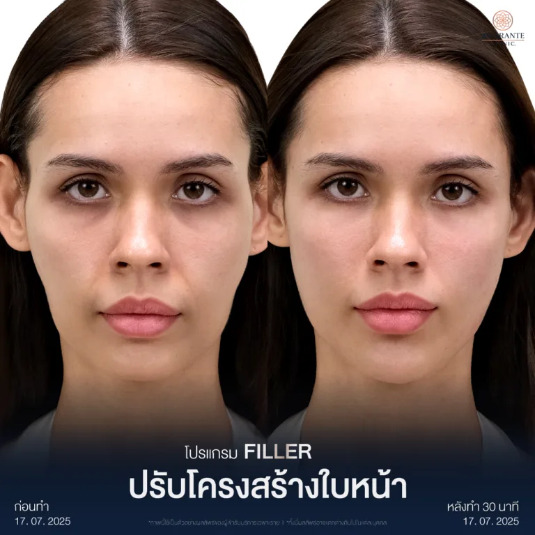 New-BA-ฟิลเลอร์-คุุณเจสสิก้า-01