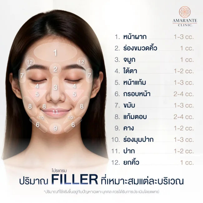 ตำแหน่งฉีดฟิลเลอร์