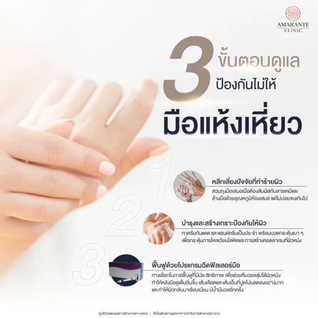 ารดูแลและรักษาไม่ให้มือแห้งเหี่ยว