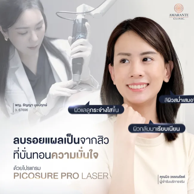 ปัญหารอยแผลเป็นจากสิวทำให้บหน้าไม่เรียบเนียน สร้างความไม่มั่นใจ