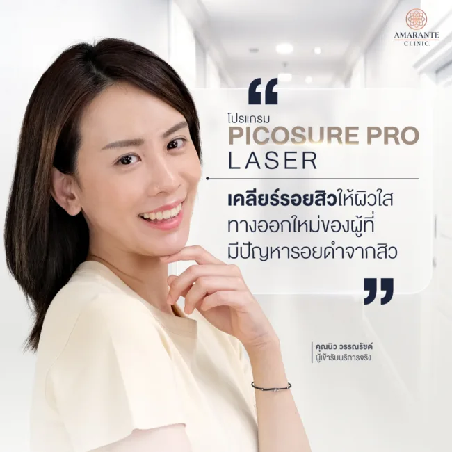 แก้ไขปัญหารอยแผลเป็นจากสิวให้คุณนิว วรรณรัชต์ ด้วยโปรแกรม Picosure Pro เทคโนโลยีเครื่องยิงเลเซอร์