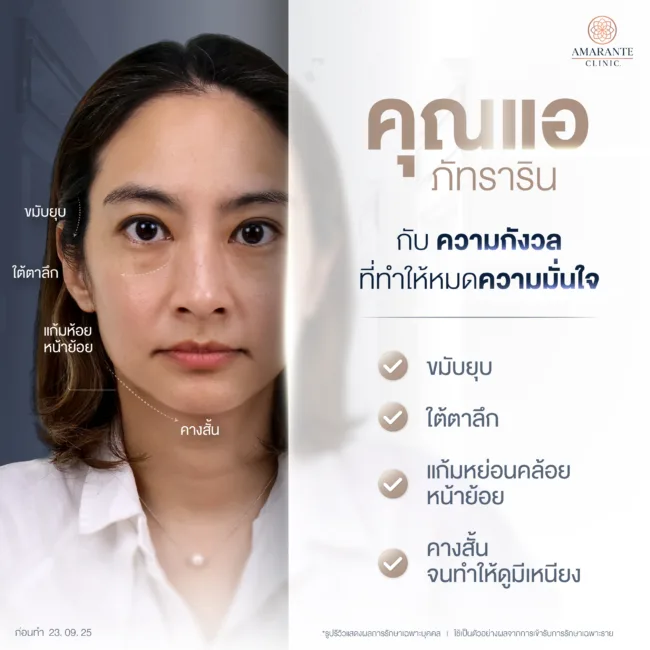 คุณแอร์ ภัทราริน เล่าถึงปัญหาจากใบหน้าแก้มหย่อนคล้อย ใต้ตาลึก ขมับยุบและคางสั้น
