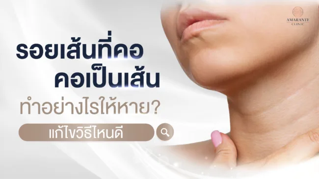 รอยเส้นที่คอ คอเป็นเส้น