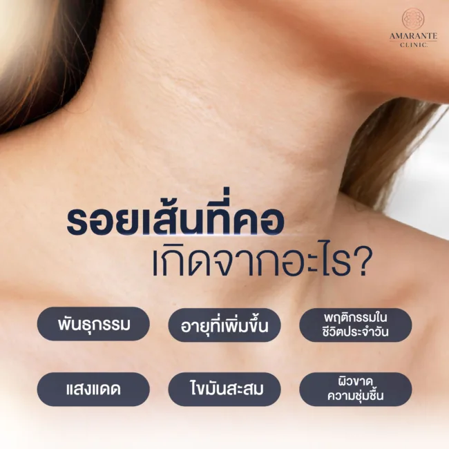 รอยเส้นที่คอ คอเป็นเส้น เกิดจากอะไร