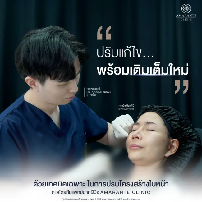 สลายฟิลเลอร์ใต้ตาAmarante
