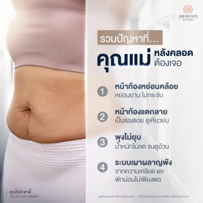 ปัญหาหน้าท้องไม่เหมือนเดิมหลังคลอด