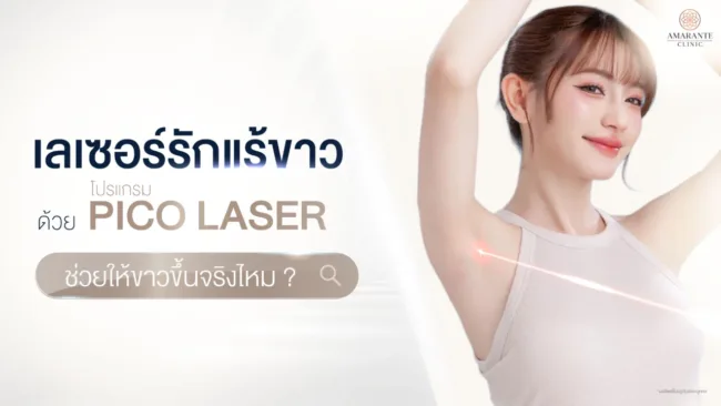เลเซอร์รักแร้ขาว คืออะไร? ต้องทำกี่ครั้งเห็นผล?