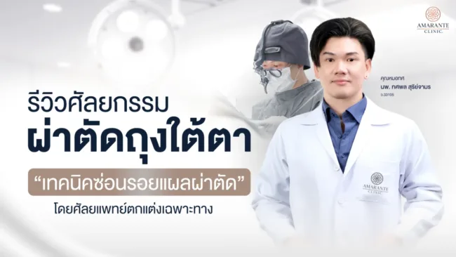 รีวิวศัลยกรรมผ่าตัดถุงใต้ตา