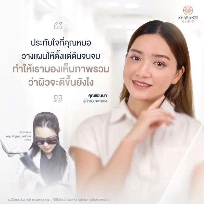 รีวิว Aviclear รักษาสิว