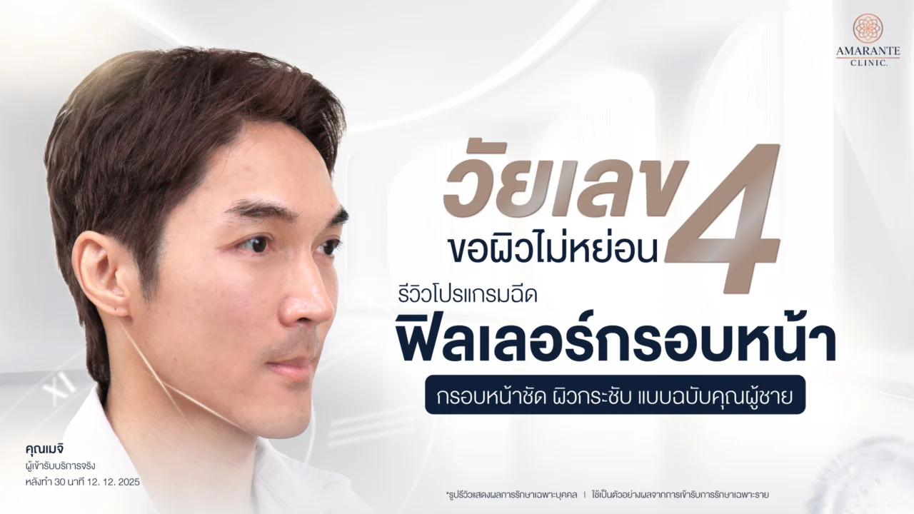 รีวิวฉีดฟิลเลอร์กรอบหน้าผู้ชายที่ Amarante Clinic
