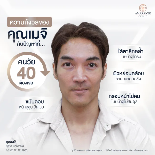 ปัญหาก่อนฉีดฟิลเลอร์กรอบหน้าคุณผู้ชาย