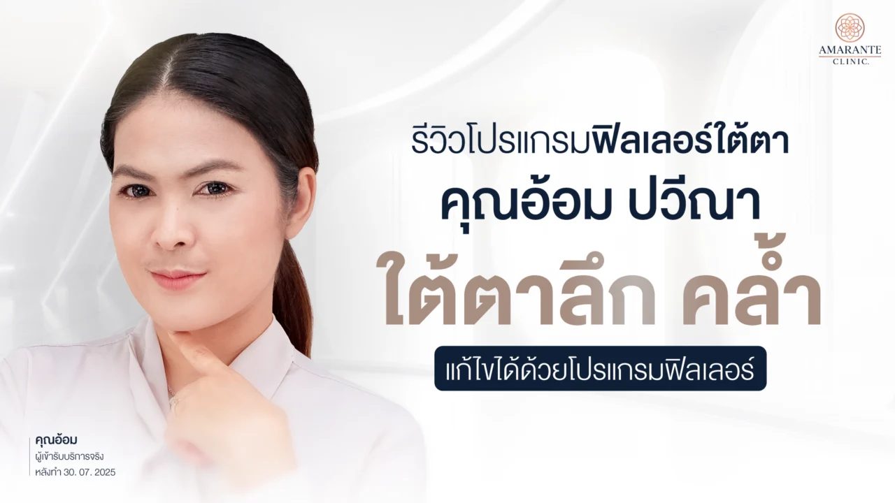 รีวิว Filler ใต้ตา คุณอ้อม ปวีณา ใต้ตาลึก Amarante Clinic