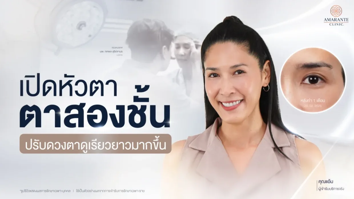 เปิดหัวตา ตาสองชั้น