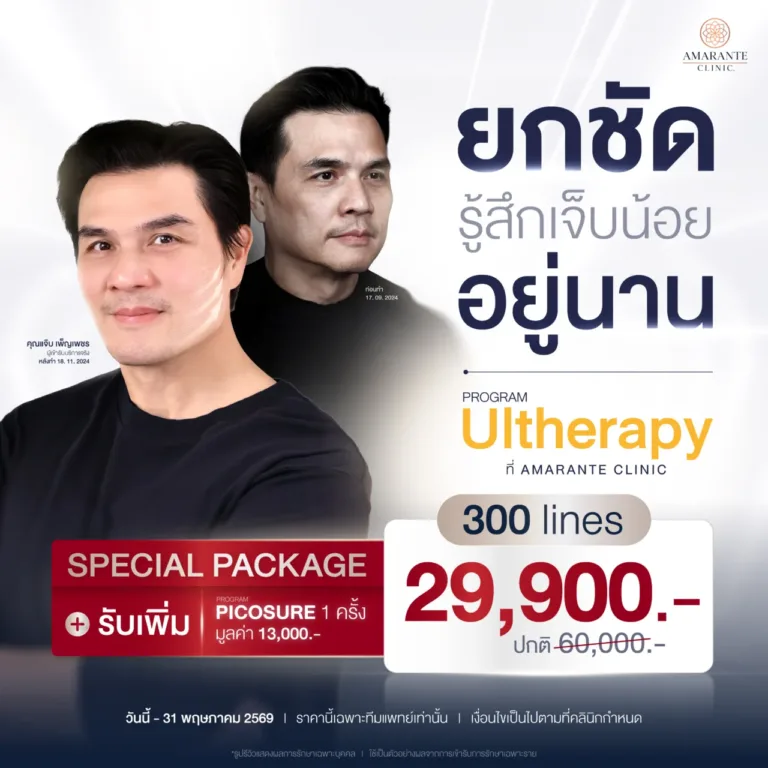 ราคา Ulthera Prime 300 line