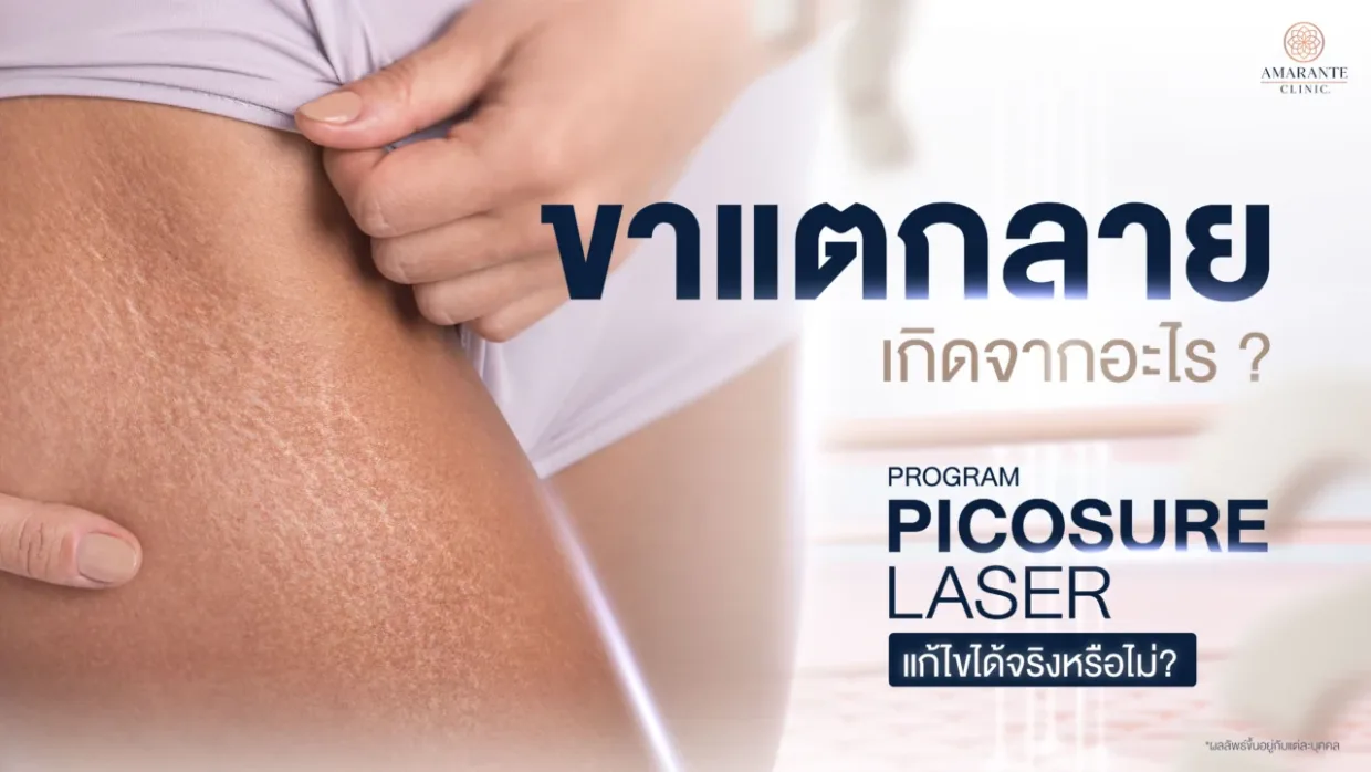 ขาแตกลายเกิดจากอะไร วิธีรักษา