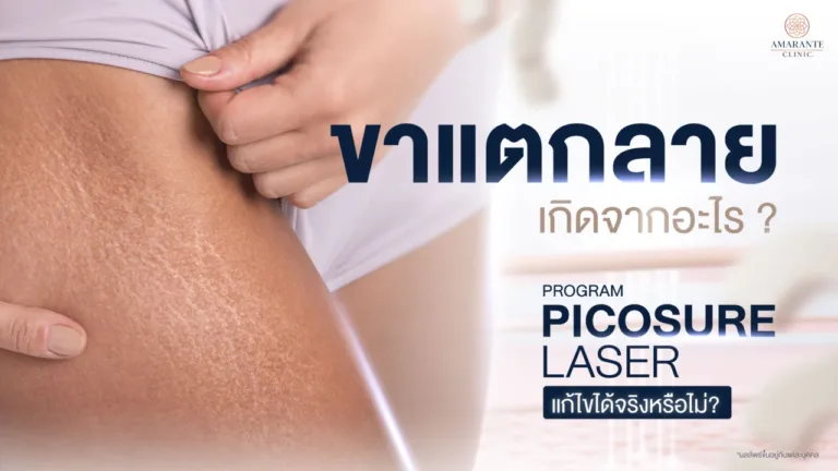ขาแตกลายเกิดจากอะไร วิธีรักษา