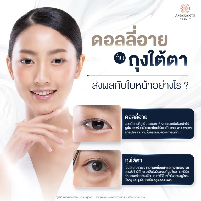 ดอลลี่อายกับถุงใต้ตาส่งผลกับใบหน้าอย่างไร