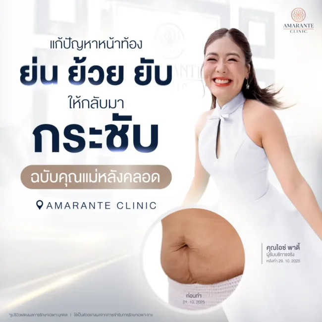 แก้หน้าท้องย้วยหลังคลอด ที่ Amarante Clinic
