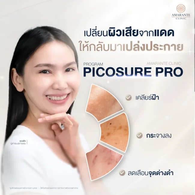 หลังแก้ไขฝ้า กระ จุดด่างดำ จากแสงแดดด้วยPicosure Laser ที่ Amarante Clinic