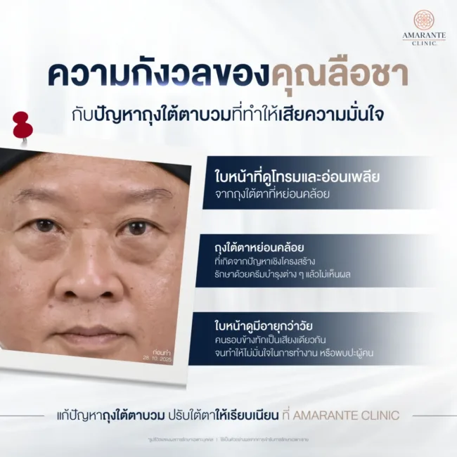 คุณลือชาเคสปัญหาอายุที่มากขึ้นของคุณลือชาทำให้เกิดถุงใต้ตาหย่อนคล้อย หน้าโทรม หม่นหมอง