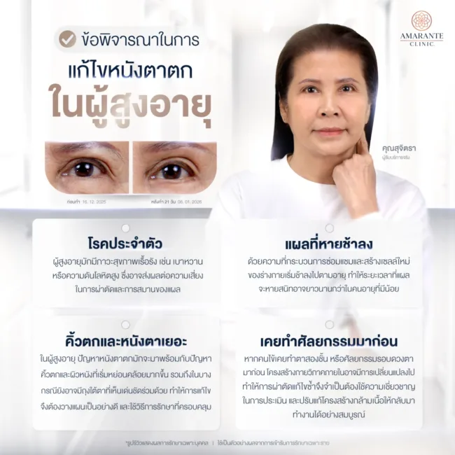 การแก้ไขหนังตาตกผู้สูงอายุ