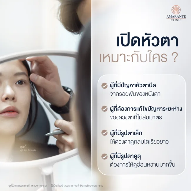 เปิดหัวตาเหมาะกับใคร