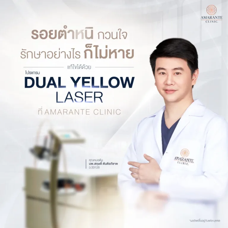 Dual Yellow Laser ที่ Amarante Clinic
