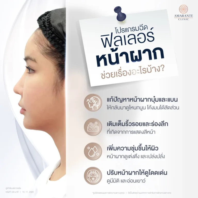 ฉีดฟิลเลอร์หน้าผากช่วยเรื่องอะไรบ้าง?