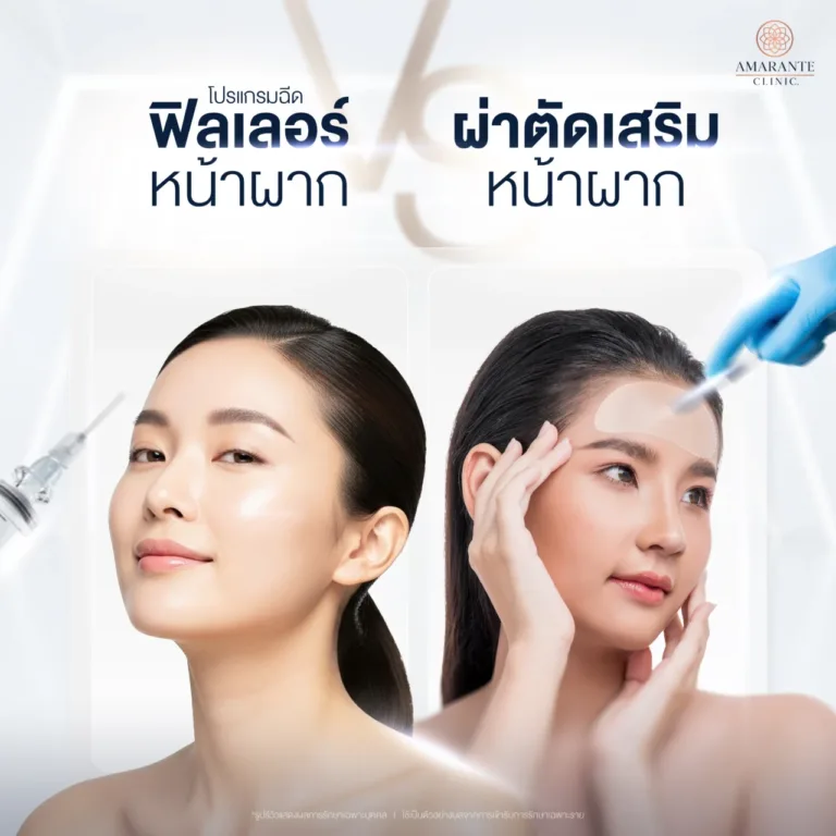 ฉีดฟิลเลอร์หน้าผากหรือเสริมหน้าผาก