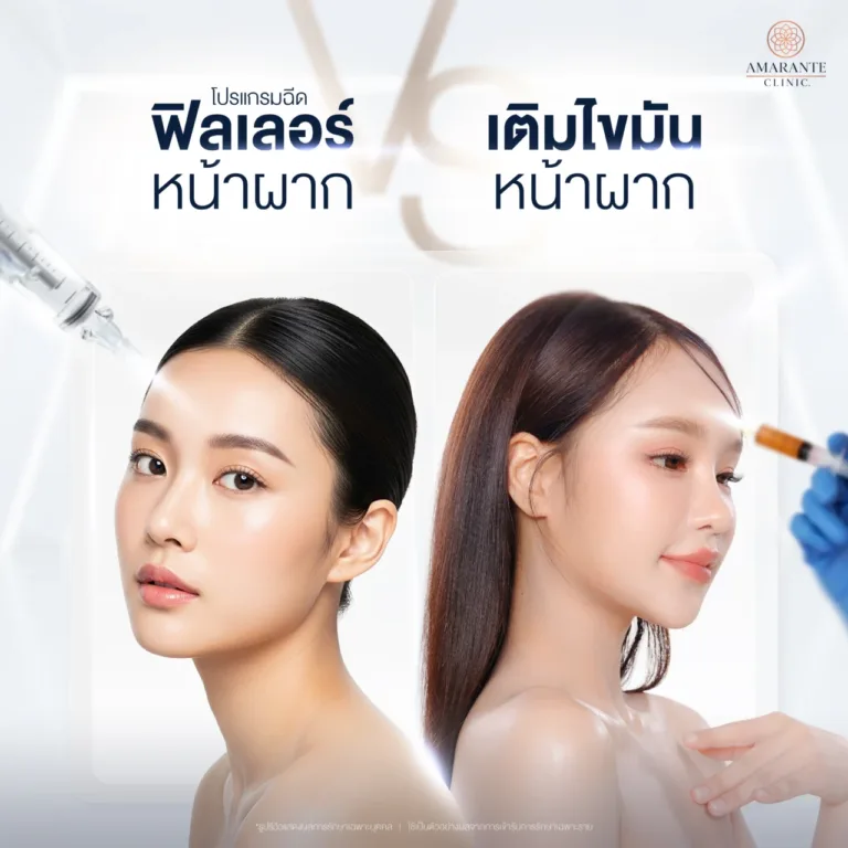 ฉีดฟิลเลอร์หน้าผากหรือการเติมไขมันหน้าผาก