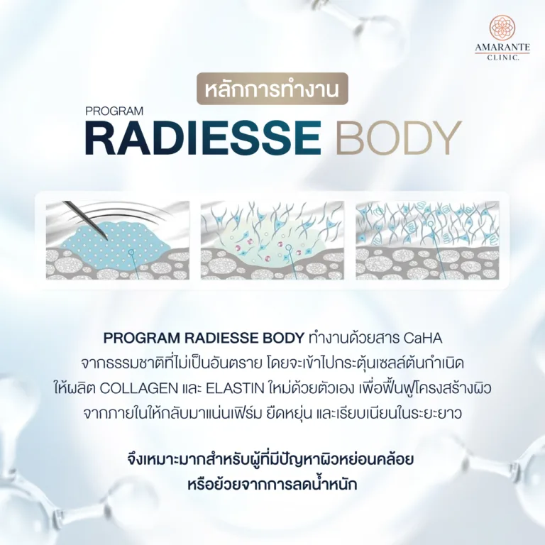 โปรแกรม Radiesse Body มีหลักการทำงานอย่างไร?