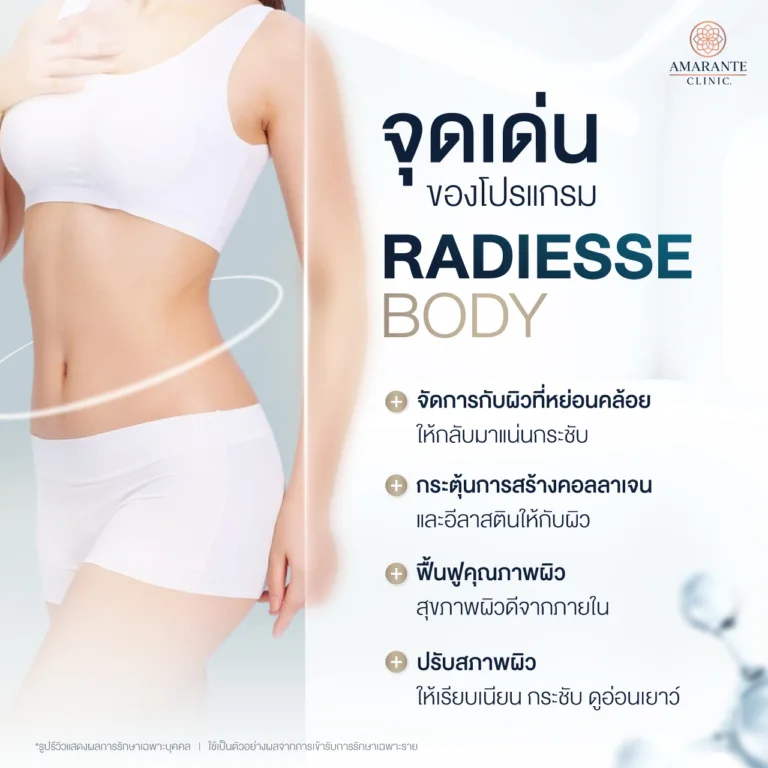 โปรแกรม Radiesse ช่วยเรื่องอะไรได้บ้าง?