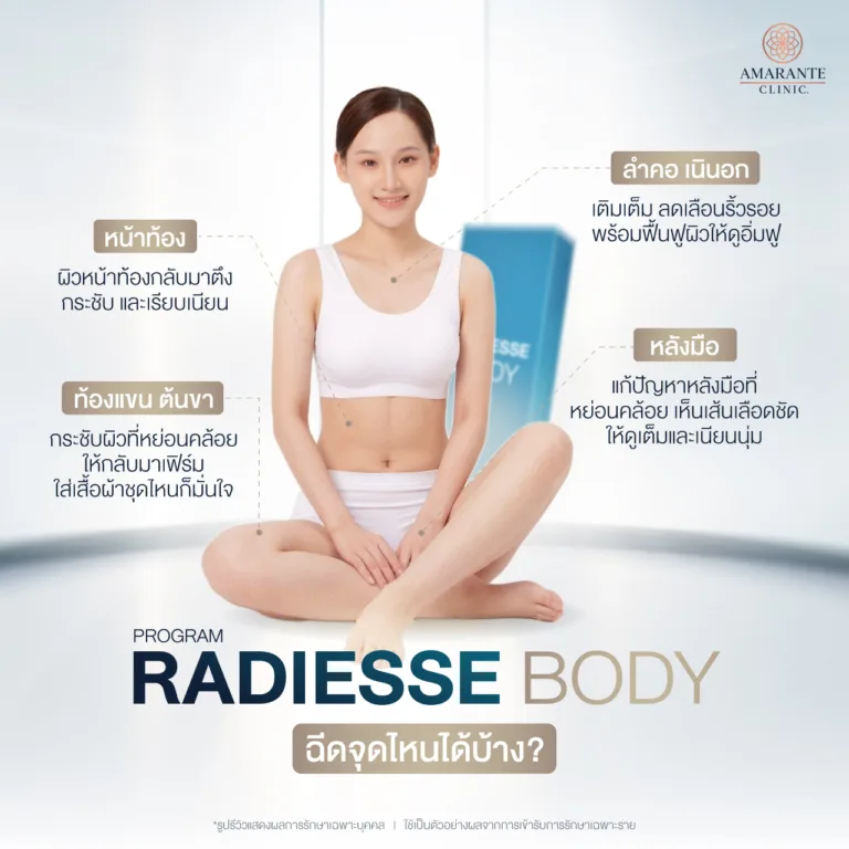โปรแกรม Radiesse Body ฉีดตรงไหนได้บ้าง