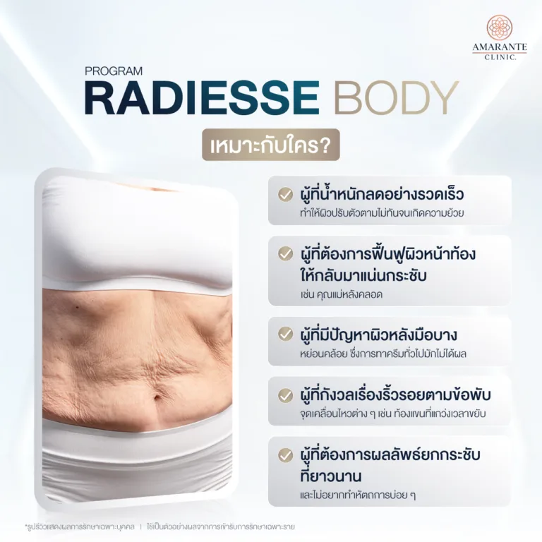 โปรแกรม Radiesse Body เหมาะกับใคร?